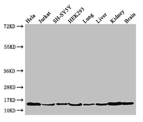 PAIP2 Antibody - Western Blot Positive WB detected in: Hela whole cell lysate, Jurkat whole cell lysate, SH-SY5Y whole cell lysate, HEK293 whole cell lysate, Mouse lung tissue, Mouse liver tissue, Mouse kidney tissue, Mouse brain tissue All lanes: PAIP2 antibody at 3.5µg/ml Secondary Goat polyclonal to rabbit IgG at 1/50000 dilution Predicted band size: 15 kDa Observed band size: 15 kDa