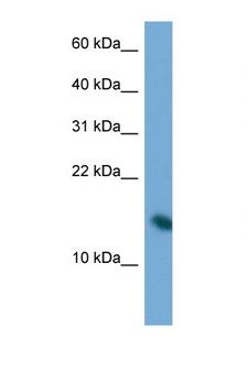 PAIP2 Antibody - PAIP2 antibody Western blot of Jurkat Cell lysate. Antibody concentration 1 ug/ml.  This image was taken for the unconjugated form of this product. Other forms have not been tested.