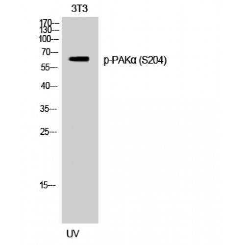 PAK1 Antibody - Western blot of Phospho-PAK alpha (S204) antibody