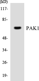 PAK1 Antibody - Western blot analysis of the lysates from COLO205 cells using PAK1 antibody.