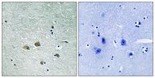 PAK1 Antibody - Immunohistochemistry analysis of paraffin-embedded human brain tissue, using PAK1 Antibody. The picture on the right is blocked with the synthesized peptide.