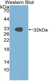 PAK1 Antibody - Western blot of recombinant PAK1.