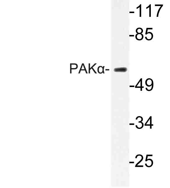 PAK1 Antibody - Western blot of PAK (E195) pAb in extracts from K562 cells.