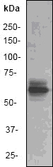 PAK1 Antibody - Western blot of PAK1 (I206) pAb in extracts from 293 cells treated with Etoposide 25uM 60'.