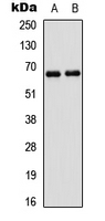 PAK1 Antibody - Western blot analysis of PAK1 expression in A431 (A); HEK293T (B) whole cell lysates.