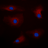 PAK1 Antibody - Immunofluorescent analysis of PAK1 staining in HEK293T cells. Formalin-fixed cells were permeabilized with 0.1% Triton X-100 in TBS for 5-10 minutes and blocked with 3% BSA-PBS for 30 minutes at room temperature. Cells were probed with the primary antibody in 3% BSA-PBS and incubated overnight at 4 deg C in a humidified chamber. Cells were washed with PBST and incubated with a DyLight 594-conjugated secondary antibody (red) in PBS at room temperature in the dark. DAPI was used to stain the cell nuclei (blue).