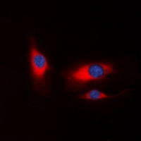 PAK1 Antibody - Immunofluorescent analysis of PAK1 staining in HeLa cells. Formalin-fixed cells were permeabilized with 0.1% Triton X-100 in TBS for 5-10 minutes and blocked with 3% BSA-PBS for 30 minutes at room temperature. Cells were probed with the primary antibody in 3% BSA-PBS and incubated overnight at 4 deg C in a humidified chamber. Cells were washed with PBST and incubated with a DyLight 594-conjugated secondary antibody (red) in PBS at room temperature in the dark. DAPI was used to stain the cell nuclei (blue).