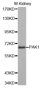 PAK1 Antibody - Western blot analysis of extracts of mouse kidney cells.