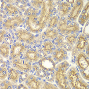 PAK1 Antibody - Immunohistochemistry of paraffin-embedded rat kidney tissue.