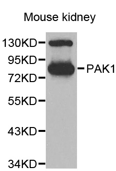 PAK1 Antibody - Western blot analysis of extracts of 293T cells.