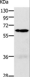 PAK1 Antibody - Western blot analysis of 293T and K562 cell, using PAK1 Polyclonal Antibody at dilution of 1:700.