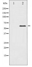 PAK1 Antibody - Western blot of PAK1 expression in Etoposide treated 293 whole cell lysates,The lane on the left is treated with the antigen-specific peptide.