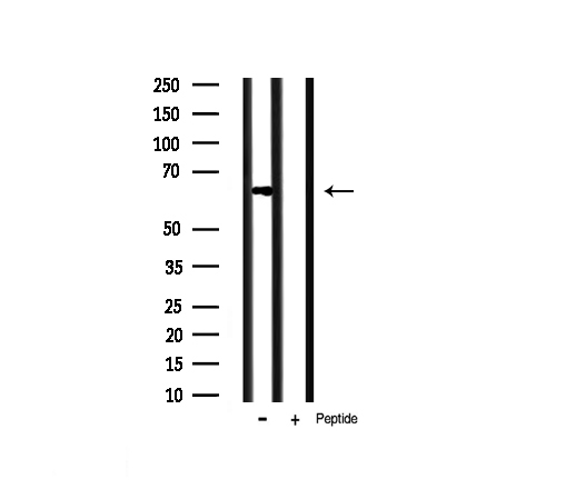 PAK1 Antibody - Western blot analysis of PAK1 expression in mouse brain tissue lysates. The lane on the right is treated with the antigen-specific peptide.