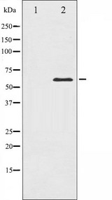 PAK1 Antibody - Western blot analysis of PAK1 expression in Etoposide treated 293 whole cells lysates. The lane on the left is treated with the antigen-specific peptide.
