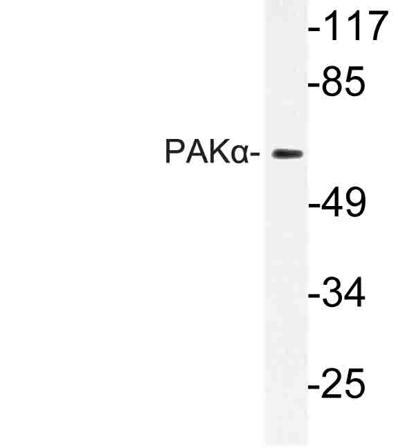 PAK1 Antibody - Western blot of PAK (K198) pAb in extracts from 3T3 cells.