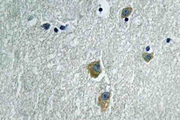 PAK1 Antibody - IHC of PAK (K198) pAb in paraffin-embedded human brain tissue.