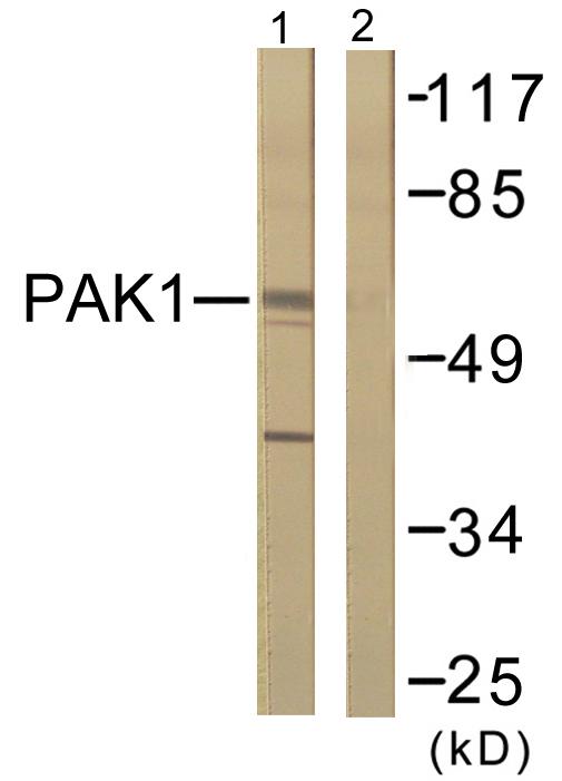 PAK1 Antibody - Western blot analysis of extracts from 293 cells, treated with Etoposide (25uM, 60mins), using PAK1 (Ab-212) antibody.