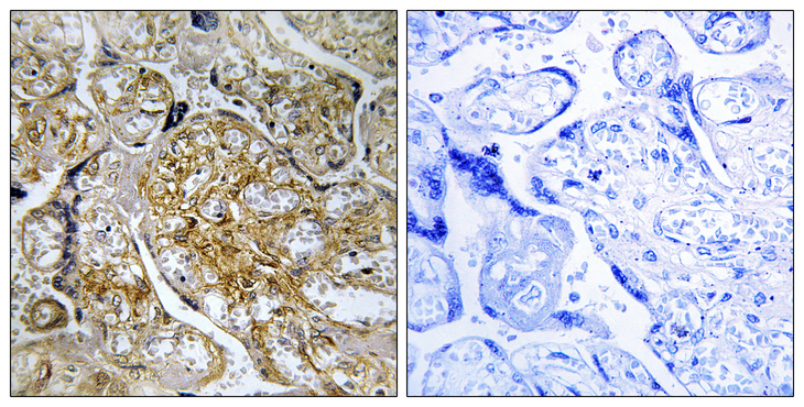 PAK1 Antibody - Immunohistochemistry analysis of paraffin-embedded human placenta, using PAK1 (Phospho-Ser199) Antibody. The picture on the right is blocked with the phospho peptide.