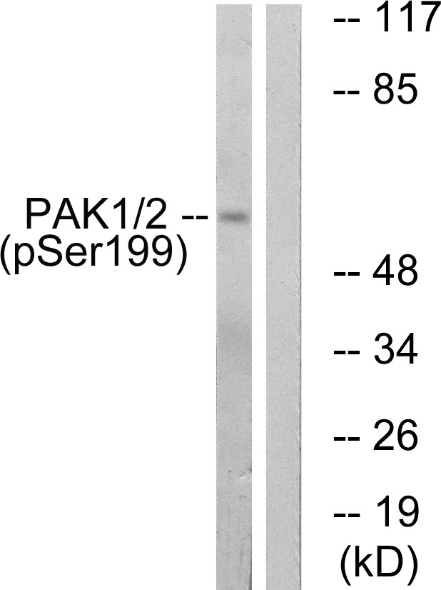 PAK1 Antibody - Western blot analysis of lysates from LOVO cells treated with starved 24h, using PAK1 (Phospho-Ser199) Antibody. The lane on the right is blocked with the phospho peptide.
