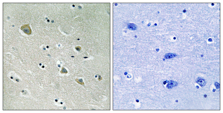 PAK1 Antibody - Immunohistochemistry analysis of paraffin-embedded human brain, using PAK1 (Phospho-Ser204) Antibody. The picture on the right is blocked with the phospho peptide.