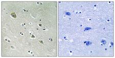 PAK1 Antibody - Immunohistochemistry analysis of paraffin-embedded human brain, using PAK1 (Phospho-Ser204) Antibody. The picture on the right is blocked with the phospho peptide.