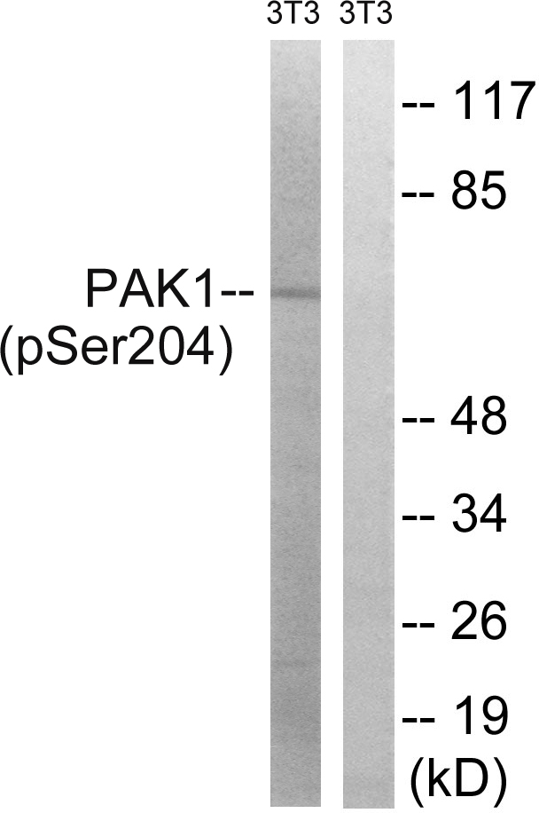 PAK1 Antibody - Western blot analysis of lysates from NIH/3T3 cells treated with UV 15', using PAK1 (Phospho-Ser204) Antibody. The lane on the right is blocked with the phospho peptide.