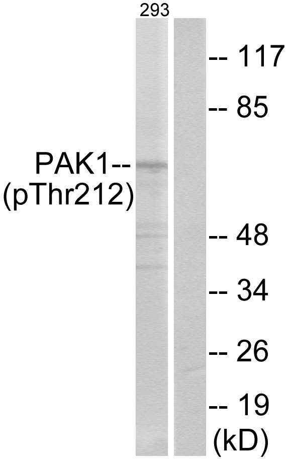 PAK1 Antibody - Western blot analysis of lysates from 293 cells treated with etoposide 25uM 1h, using PAK1 (Phospho-Thr212) Antibody. The lane on the right is blocked with the phospho peptide.