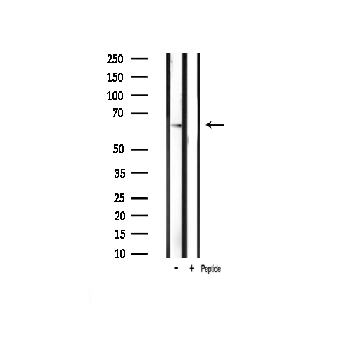 PAK1 Antibody - Western blot analysis of PAK1 phosphorylation expression in mouse brain tissue lysates. The lane on the right is treated with the antigen-specific peptide.