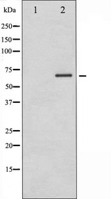 PAK1 Antibody - Western blot analysis of PAK1 phosphorylation expression in etoposide treated 293 whole cells lysates. The lane on the left is treated with the antigen-specific peptide.