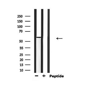 PAK1 Antibody - Western blot analysis of extracts of mouse brain tissue using Phospho-PAK1 (Thr212) antibody.
