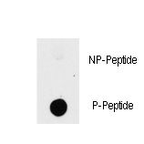 PAK1 Antibody - Dot blot of anti-PAK1-pT423 Phospho-specific antibody on nitrocellulose membrane. 50ng of Phospho-peptide or Non Phospho-peptide per dot were adsorbed. Antibody working concentrations are 0.5ug per ml.
