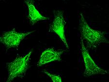 PAK1 Antibody - Immunofluorescence staining of PAK1 in HeLa cells. Cells were fixed with 4% PFA, permeabilzed with 0.3% Triton X-100 in PBS, blocked with 10% serum, and incubated with rabbit anti-rat PAK1 polyclonal antibody (dilution ratio: 1:5000) at 4°C overnight. Then cells were stained with the Alexa Fluor 488-conjugated Goat Anti-rabbit IgG secondary antibody (green). Positive staining was localized to cytoplasm.