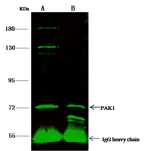 PAK1 Antibody - PAK1 was immunoprecipitated using: Lane A: 0.5 mg 293T Whole Cell Lysate. Lane B: 0.5 mg NIH-3T3 Whole Cell Lysate. 1 uL anti-PAK1 rabbit polyclonal antibody and 15 ul of 50% Protein G agarose. Primary antibody: Anti-PAK1 rabbit polyclonal antibody, at 1:100 dilution. Secondary antibody: Dylight 800-labeled antibody to rabbit IgG (H+L), at 1:5000 dilution. Developed using the odssey technique. Performed under reducing conditions. Predicted band size: 66 kDa. Observed band size: 72 kDa.