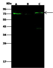 PAK1 Antibody - Anti-PAK1 rabbit polyclonal antibody at 1:500 dilution. Lane A: HeLa Whole Cell Lysate. Lane B: A431 Whole Cell Lysate. Lane C: 293 Whole Cell Lysate. Lysates/proteins at 30 ug per lane. Secondary: Goat Anti-Rabbit IgG H&L (Dylight 800) at 1/10000 dilution. Developed using the Odyssey technique. Performed under reducing conditions. Predicted band size: 65 kDa. Observed band size: 72 kDa. (We are unsure as to the identity of these extra bands.)