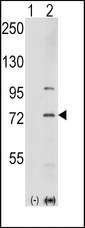 PAK1 Antibody - Western blot of PAK1 (arrow) using rabbit polyclonal PAK1 Antibody (T423). 293 cell lysates (2 ug/lane) either nontransfected (Lane 1) or transiently transfected with the PAK1 gene (Lane 2) (Origene Technologies).