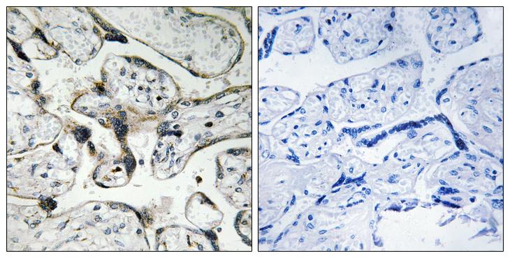 PAK1 / PAK2 Antibody - Peptide - + Immunohistochemistry analysis of paraffin-embedded human placenta tissue using PAK1/2 (Ab-199) antibody.