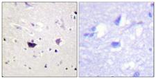PAK1 + PAK2 + PAK3 Antibody - Immunohistochemistry analysis of paraffin-embedded human brain tissue, using PAK1/2/3 Antibody. The picture on the right is blocked with the synthesized peptide.