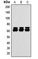PAK1 + PAK2 + PAK3 Antibody - Western blot analysis of PAK1/2/3 expression in HEK293T (A); HeLa (B); NIH3T3 (C) whole cell lysates.