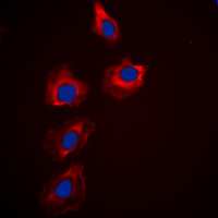 PAK1 + PAK2 + PAK3 Antibody - Immunofluorescent analysis of PAK1/2/3 staining in HeLa cells. Formalin-fixed cells were permeabilized with 0.1% Triton X-100 in TBS for 5-10 minutes and blocked with 3% BSA-PBS for 30 minutes at room temperature. Cells were probed with the primary antibody in 3% BSA-PBS and incubated overnight at 4 deg C in a humidified chamber. Cells were washed with PBST and incubated with a DyLight 594-conjugated secondary antibody (red) in PBS at room temperature in the dark. DAPI was used to stain the cell nuclei (blue).