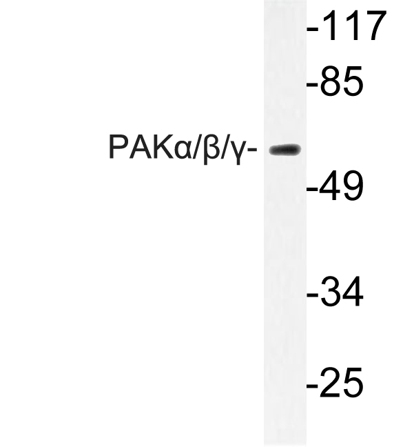 PAK1 + PAK2 + PAK3 Antibody - Western blot of PAK1 (I206) pAb in extracts from 293 cells treated with Etoposide 25uM 60'.
