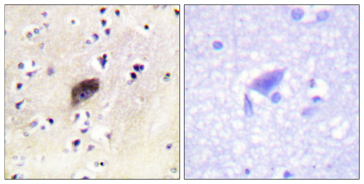 PAK1 + PAK2 + PAK3 Antibody - Immunohistochemistry analysis of paraffin-embedded human brain, using PAK1/2/3 (Phospho-Ser144/141/139) Antibody. The picture on the right is blocked with the phospho peptide.