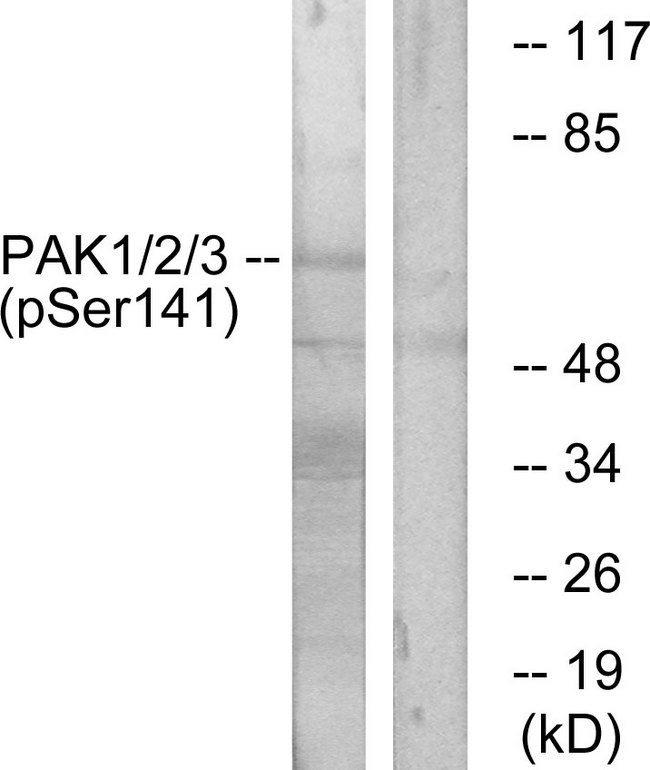PAK1 + PAK2 + PAK3 Antibody - Western blot analysis of lysates from mouse brain, using PAK1/2/3 (Phospho-Ser144/141/139) Antibody. The lane on the right is blocked with the phospho peptide.