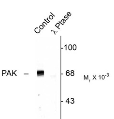 PAK1 + PAK2 + PAK3 Antibody - Western blot of rat hippocampal lysate showing specific immunolabeling of the -68k to -70k PAK protein (Control). The phosphospecificity of this labeling is shown in the second lane (lambda-phosphatase: lambda phosphatase). The blot is identical to the co.