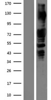PAK1 Protein - Western validation with an anti-DDK antibody * L: Control HEK293 lysate R: Over-expression lysate