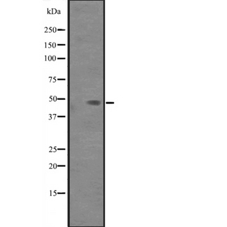 PAK1IP1 / HPIP1 Antibody - Western blot analysis of PAK1IP1 expression in PAK1 interacting protein 1 transfected 293T cells lysate. The lane on the left is treated with the antigen-specific peptide.