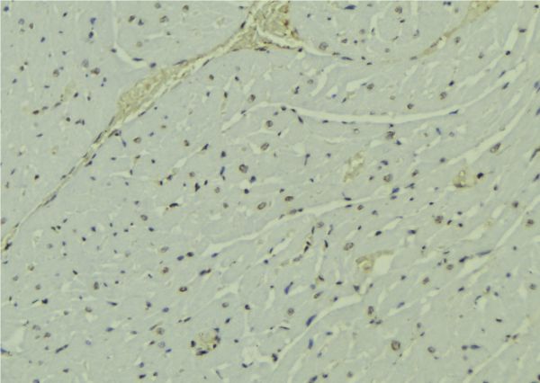 PAK1IP1 / HPIP1 Antibody - 1:100 staining mouse muscle tissue by IHC-P. The sample was formaldehyde fixed and a heat mediated antigen retrieval step in citrate buffer was performed. The sample was then blocked and incubated with the antibody for 1.5 hours at 22°C. An HRP conjugated goat anti-rabbit antibody was used as the secondary.