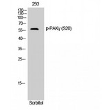 PAK2 Antibody - Western blot of Phospho-PAK gamma (S20) antibody