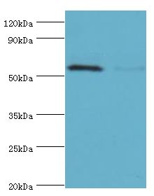 PAK2 Antibody - Western blot. All lanes: Serine/threonine-protein kinase PAK 2 antibody at 2 ug/ml. Lane 1: Jurkat whole cell lysate. Lane 2: HeLa whole cell lysate. secondary Goat polyclonal to rabbit at 1:10000 dilution. Predicted band size: 58 kDa. Observed band size: 58 kDa.