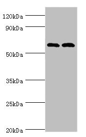 PAK2 Antibody - Western blot All lanes: Serine/threonine-protein kinase PAK 2 antibody at 2µg/ml Lane 1: Jurkat whole cell lysate Lane 2: Hela whole cell lysate Secondary Goat polyclonal to rabbit IgG at 1/10000 dilution Predicted band size: 58 kDa Observed band size: 58 kDa