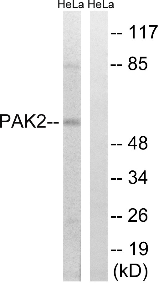 PAK2 Antibody - Western blot analysis of lysates from HeLa cells, treated with TSA 400nM 24H, using PAK2 Antibody. The lane on the right is blocked with the synthesized peptide.